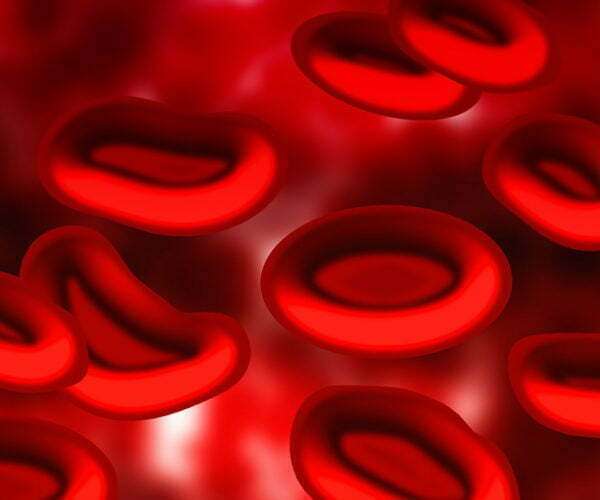 Hipótesis del factor Rh negativo